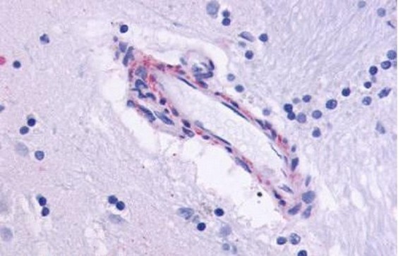 Immunohistochemical analysis of formalin fixed, paraffin embedded Human brain tissue (vessel) labeling Muscarinic Acetylcholine Receptor M5 with ab150531 at 6 µg/ml.