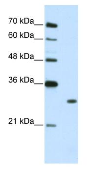 Lane 1 :  MarkerLane 2 :  Anti-Muscleblind-like 1 antibody (ab50635) at 2.5 µg/mlLane 1 : MarkerLane 2 : Jurkat cell lysate at 10 µgSecondaryLane 2 : HRP conjugated anti-Rabbit IgG at 1/50000 dilution