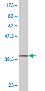 Anti-MVK antibody (ab77463) at 1/500 dilution + immunogen at 0.2 µgSecondaryGoat anti-mouse IgG (H&L)-HRP conjugate at 1/5000 dilution