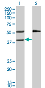 All lanes : Anti-MVK antibody (ab77463) at 1/500 dilutionLane 1 : MVK transfected 293T cell lysateLane 2 : Non transfected 293T cell lysateLysates/proteins at 25 µg per lane.SecondaryGoat anti-mouse IgG (H&L)-HRP conjugate at 1/2500 dilution