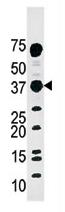 Anti-MVK antibody - Aminoterminal end (ab71458) at 1/60 dilution + Mouse kidney tissue lysate at 12.5 µgObserved band size : 42 kDa (why is the actual band size different from the predicted?)