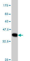 Western blot against tagged recombinant protein immunogen using ab55559 MYBPC1 antibody at 1ug/ml.
