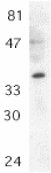 Anti-MyD88 antibody (ab2064) at 1/500 dilution + Jurkat Whole Cell Lysate