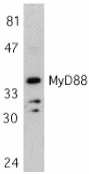 Anti-MyD88 antibody (ab2068) at 1 µg/ml + Jurkat whole cell lysateObserved band size : 35 kDa (why is the actual band size different from the predicted?)