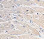 Immunohistochemical staining (paraffin embedded) of human heart tissue using anti-MyD88 at 2 µg/ml.