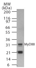 Anti-MyD88 antibody (ab47185) at 0.5 µg/ml + Human spleen cell lysate