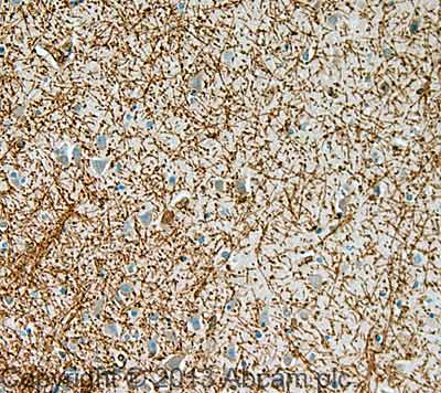 IHC image of Myelin Basic Protein staining in Human Hippocampus formalin fixed paraffin embedded tissue section, performed on a Leica Bond™ system using the standard protocol F. The section was pre-treated using heat mediated antigen retrieval with sodium citrate buffer (pH6, epitope retrieval solution 1) for 20 mins. The section was then incubated with ab124493, 5 µg/ml, for 15 mins at room temperature and detected using an HRP conjugated compact polymer system. DAB was used as the chromogen. The section was then counterstained with haematoxylin and mounted with DPX. For other IHC staining systems (automated and non-automated) customers should optimize variable parameters such as antigen retrieval conditions, primary antibody concentration and antibody incubation times.
