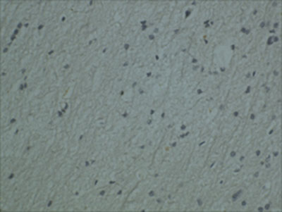 Ab49208 (1:2000) staining of myelin basic protein on normal human brain by IHC (5µm thick paraffin-embedded section). Courtesy of Dr Wei-Ping Gai, The Flinders University of South Australia. 