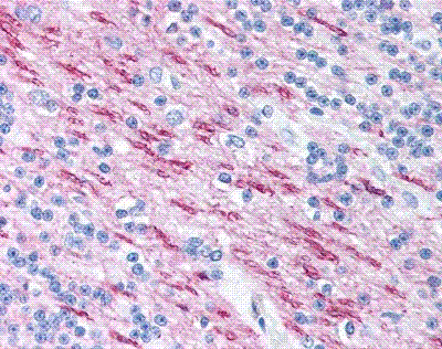 ab11223 staining Myelin Basic Protein of white matter in human brain section by Immunohistochemistry (Formalin/PFA-fixed paraffin-embedded sections).