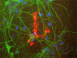 ab78157 (red) staining Myelin Basic Protein in rat mixed neuron/glial cultures. Also stained with a chicken antibody to neurofilament NF-L (green). Blue is a DNA stain. Note that ab78157 stains an oligodendrocyte and some membrane shed from this cell. Other cells in the field include neurons, astrocytes, microglia and fibroblasts, all of which are completely negative for Myelin Basic Protein, though the neuronal processes can be seen with the NF-L antibody.