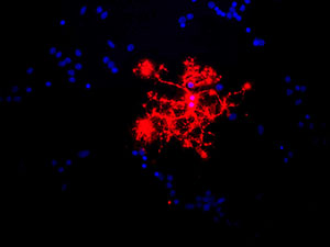 ab78156 (red), at 1/1000 dilution, staining Myelin Basic Protein in rat mixed neuron/glial cultures. Blue is a DNA stain. ab78156 stains an oligodendrocyte and some membrane shed from this cell. Other cells in the field include neurons, astrocytes, microglia and fibroblasts, all of which are completely negative.