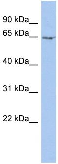 Anti-Myelin expression factor 2 antibody (ab90313) at 1 µg/ml (5% skim milk / PBS buffer) + PANC-1 cell lysate at 10 µgSecondaryHRP conjugated anti-Rabbit IgG at 1/50000 dilutionObserved band size : 64 kDa (why is the actual band size different from the predicted?)
