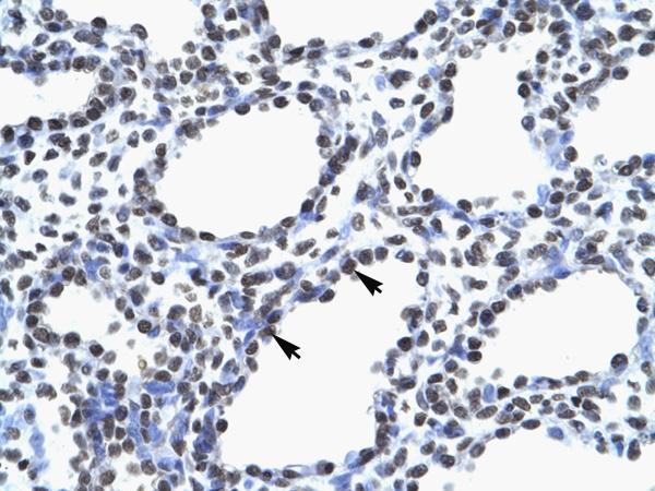 ab26098 at a concentration of 6.0 µg/ml staining human Myelin expression factor 2 by Immunohistochemistry in paraffin embedded lung tissue. Cells with positive label (as indicated by the arrows) are alveolar cells. Magnification 400X.