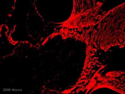 ab31851 staining rat cochlear nerve cells by ICC/IF. Cells were PFA fixed and permeabilized in 0.1% Triton X-100 prior to blocking in 5% serum for 30 minutes at 25°C. The primary antibody was diluted 1/100 (HBSS with 5% FBS) and incubated with the sample for 18 hours at 4°C. An Alexa Fluor® 568 conjugated goat anti-rabbit antibody, diluted 1/2000, was used as the secondary.See Abreview