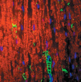 Immunohistochemical analysis of an adult sciatic nerve labelling Myelin Protein Zero in the myelin and Schwann cell processes surrounding the nodes of Ranvier with ab134439 at 1/1000 dilution (green staining). Antibodies against LAMP (lysozome-associated membrane glycoprotein) (red staining) serves as the counterstain, and DAPI (blue staining) allows visualization of nuclei.