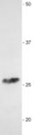 Anti-Myelin Protein Zero antibody (ab134439) at 1/2000 dilution + Adult mouse (C57 Black) sciatic nerve