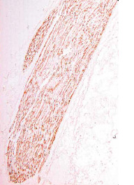 Immunohistochemical analysis of an adult sciatic nerve labelling Myelin Protein Zero in myelinating Schwann cells with ab134439 at 1/1000 dilution (brown staining).