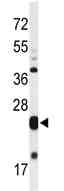Anti-Myeloid leukemia factor 1 antibody (ab103099) at 1/100 dilution + Mouse heart tissue lysate at 35 µg