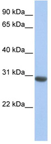 Anti-Myeloid leukemia factor 1 antibody (ab84942) at 1 µg/ml (in 5% skim milk / PBS buffer) + Human fetal liver lysate at 10 µgSecondaryanti-Rabbit IgG HRP at 1/50000 dilution