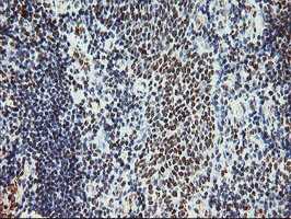 ab128108, at 1/150 dilution, staining Myeloid leukemia factor 1 in paraffin-embedded Human tonsil tissue by Immunohistochemistry.