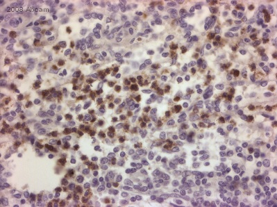 ab45977 (1/50) staining Myeloperoxidase in paraffin-embbeded human spleen tissue sections. Tissue underwent fixation in formaldehyde, heat-mediated antigen retrieval in citrate buffer pH 6.0 and blocking (5 minutes/peroxidase block and 10 minutes/protein block). For further experimental details please refer to abreview.See Abreview