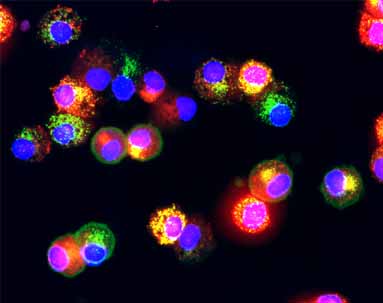 ab62141 staining of Myeloperoxidase (red) on isolated human monocytes by Immunocytochemistry/Immunofluorescence. Other structures visualised are MHC class II (green) and DNA (blue; Hoechst 33258 dye). 