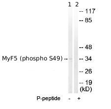 All lanes : Anti-Myf5 (phospho S49) antibody (ab63563) at 1/500 dilutionLane 1 : Extracts from HeLa cells (5-30µg) minus immunising peptideLane 2 : Extracts from HeLa cells (5-30µg) plus immunising peptide (5-10µg)