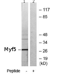 All lanes : Anti-Myf5 antibody (ab69997) at 1/500 dilutionLane 1 : Extracts from HepG2 cells, minus immunising peptideLane 2 : Extracts from HepG2 cells, plus immunising peptide at 5µgLysates/proteins at 5 µg per lane.