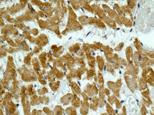Immunohistochemical analysis of paraffin embedded Human heart tissue labeling MYH7B with ab172967 at a 1/250 dilution.