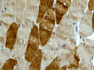 Immunohistochemical analysis of paraffin embedded Human skeletal muscle tissue labeling MYH7B with ab172967 at a 1/250 dilution.