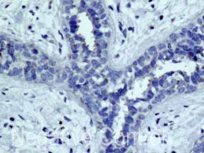 ab172967 showing -ve staining in Human normal breast tissue.