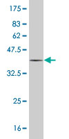 Western blot against tagged recombinant protein immunogen using ab55473 MYL6 antibody at 1ug/ml.