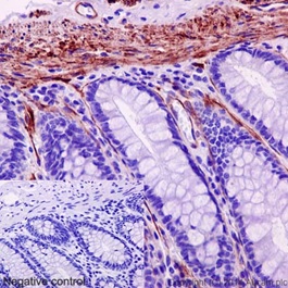 Immunohistochemical analysis of paraffin-embedded Human colon tissue labeling MYL9 with ab191393 at 1/700 dilution followed by pre-diluted HRP Polymer for Rabbit IgG secondary antibody and counter-stained with Hematoxylin. Inset: Negative control: using PBS instead of primary antibody.