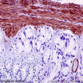 Immunohistochemical analysis of paraffin-embedded Rat colon tissue labeling MYL9 with ab191393 at 1/700 dilution followed by pre-diluted HRP Polymer for Rabbit IgG secondary antibody and counter-stained with Hematoxylin. Inset: Negative control: using PBS instead of primary antibody.