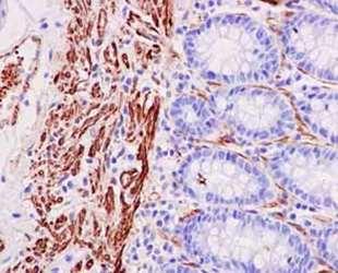 Immunohistochemical analysis of paraffin-embedded Human colon tissue labeling MYL9 with ab187152 at 1/500 dilution. Anti-rabbit IgG HRP was used as a secondary antibody and slides were counterstained with hematoxylin.