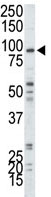 Anti-MYLK3 antibody (ab71826) at 1/100 dilution + A375 cell lysate at 12.5 µgSecondaryHRP-anti-rabbit