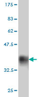Western blot against tagged recombinant protein immunogen using ab55477 Myocilin antibody at 1ug/ml. 
