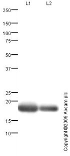 All lanes : Anti-Myoglobin antibody (ab78441) at 0.5 µg/mlLane 1 : Skeletal Muscle (Human) Tissue Lysate - adult normal tissue (ab29330)Lane 2 : Heart (Human) Tissue Lysate - adult normal tissue (ab29431)Lysates/proteins at 5 µg per lane.SecondaryGoat polyclonal to Rabbit IgG - H&L - Pre-Adsorbed (HRP) at 1/3000 dilutiondeveloped using the ECL techniquePerformed under reducing conditions.