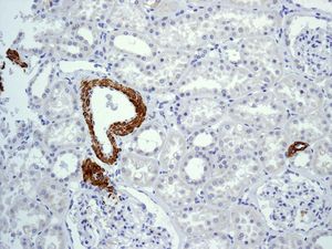 ab124679, at 1/100 dilution, staining Myosin, smooth muscle heavy chain 1 and 2 in paraffin-embedded Human kidney tissue by Immunohistochemistry.