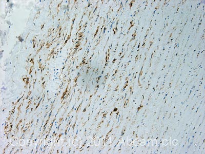 IHC image of ab82255 staining in human artery formalin fixed paraffin embedded tissue section, performed on a Leica BondTM system using the standard protocol F. The section was pre-treated using heat mediated antigen retrieval with sodium citrate buffer (pH6, epitope retrieval solution 1) for 20 mins. The section was then incubated with ab82255, 1µg/ml, for 15 mins at room temperature and detected using an HRP conjugated compact polymer system. DAB was used as the chromogen. The section was then counterstained with haematoxylin and mounted with DPX.For other IHC staining systems (automated and non-automated) customers should optimize variable parameters such as antigen retrieval conditions, primary antibody concentration and antibody incubation times.