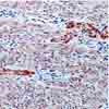 Human uterus stained with anti-Myosin, (ab17811)
