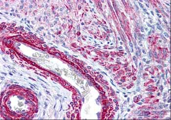 IHC-P of ab2480 at 2.5 µg/ml staining both vascular and myometrial smooth muscle cells of the uterus.  The image shows localization of the antibody as the precipitated red signal, with a hematoxylin purple nuclear counterstain.