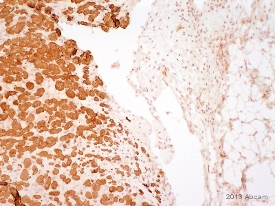 ab98594 staining Myosin Light Chain 2 in Rabbit heart tissue sections by Immunohistochemistry (IHC-P - paraformaldehyde-fixed, paraffin-embedded sections). Tissue was fixed with formaldehyde and blocked with 10% serum for 60 minutes; antigen retrieval was by heat mediation in a Tris/EDTA buffer. Samples were incubated with primary antibody (1/500 in PBS-T) for 1 hour at 37°C. A HRP-conjugated Goat anti-mouse polyclonal (1/1000) was used as the secondary antibody.See Abreview