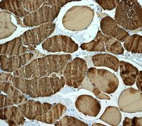 Immunohistochemical staining of paraffin-embedded human skeletal muscle tissue using ab108923 at a diltion of 1/100.