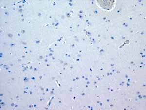 ab108923 showing negative staining in Normal brain tissue.