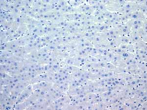 ab108923 showing negative staining in Normal liver tissue.