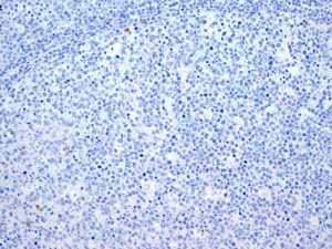 ab108923 showing negative staining in Normal tonsil tissue.