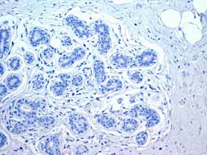 ab108923 showing negative staining in Normal breast tissue.