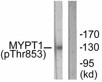 All lanes : Anti-Myosin Phosphatase (phospho T853) antibody (ab59203) at 1/500 dilutionLane 1 : NIH/3T3 cell extractLane 2 : NIH/3T3 cell extract with immunizing phosphopeptide