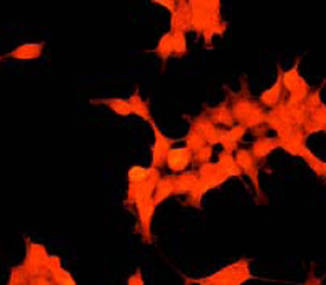 ab32519 at a 1:100 dilution staining Myosin Phosphatase 1 / Myosin Phosphatase 2 in 293 cells using Immunocytochemistry/Immunofluorescence.